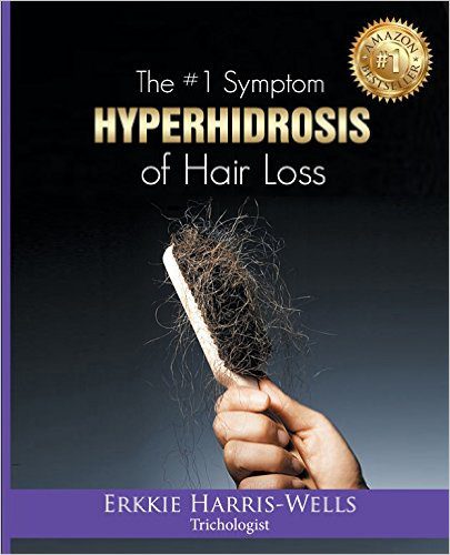 Hyperhidrosis: The Number One Symptom of Hair Loss